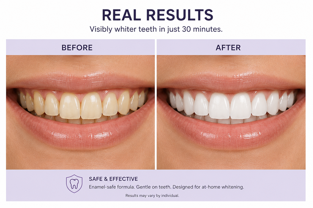 Advanced purple whitening strips